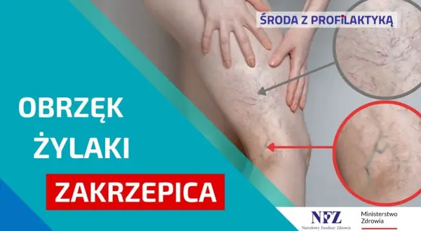 Jak zapobiec zakrzepicy? Skuteczna profilaktyka krok po kroku
