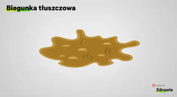 Ilustracja przedstawia brązową, oleistą plamę, symbolizującą biegunka tłuszczowa.